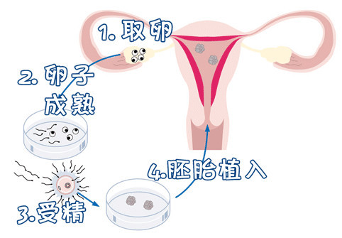 借卵代孕一站式服务